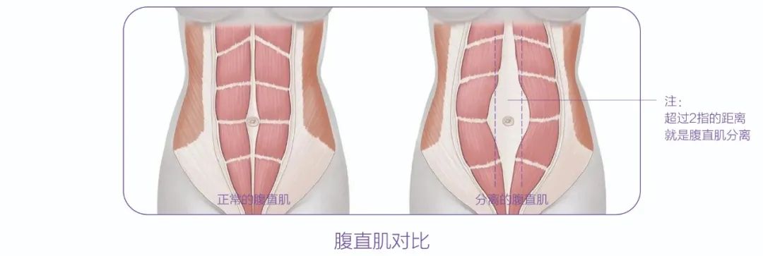 生完孩子就“分开”？！产后妈妈 你得这样“自救”(图4)